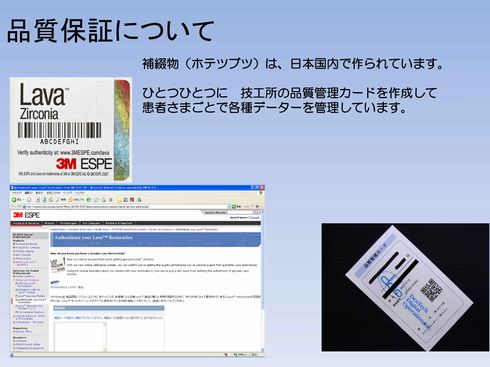 オールセラミックスの品質保証 オールセラミックスの品質保証