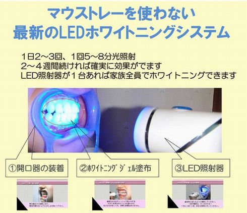 ＬＥＤホワイトニング