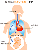 全身への影響